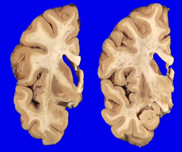 14A2 MSA (SND, Case 14) 8