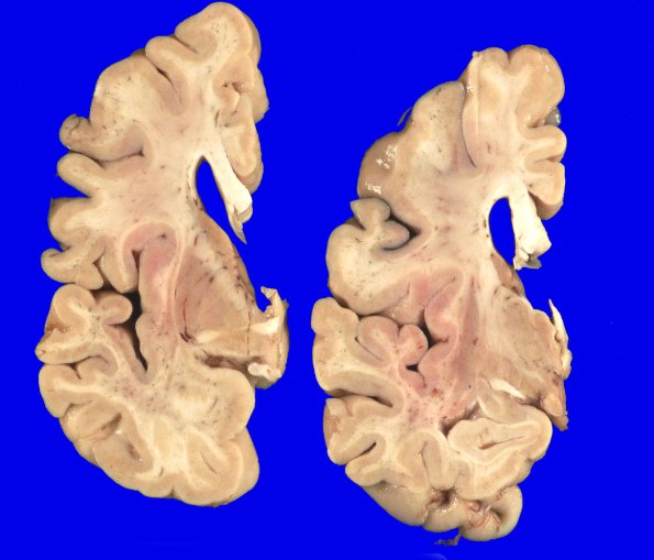 15A2 MSA (Case 15) _13