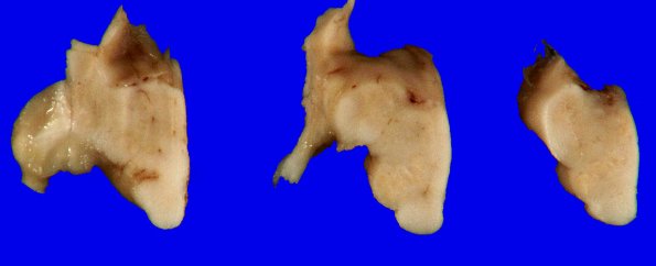 15A8 MSA (Case 15) _8