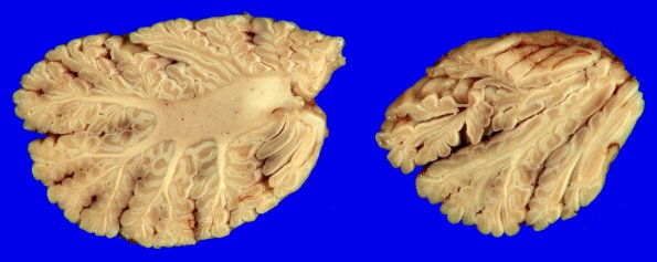 16A10 MSA (Case 16)_15