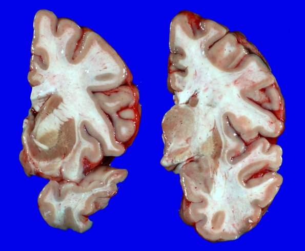 16A2 MSA (Case 16)_8