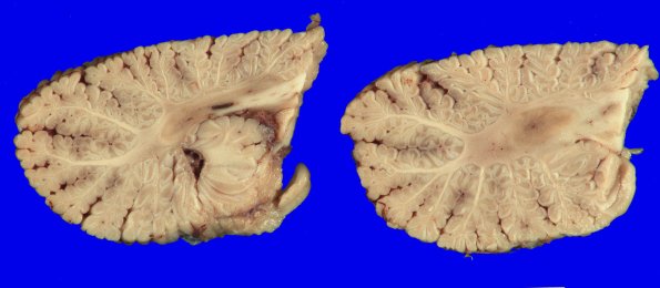16A9 MSA (Case 16)_14