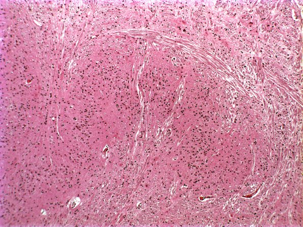 17C2 MSA (Case 17) ION c