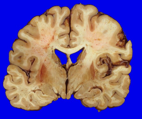 19A1 MSA (Case 19) 1