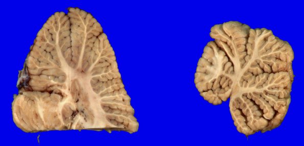 1A2 MSA (Case 1) Gross_5