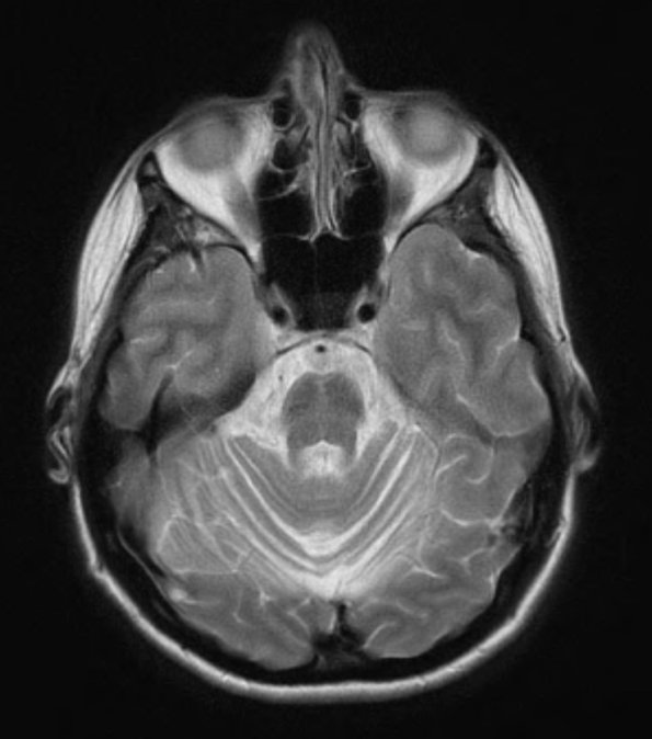 20A4 MSA (Case 20) T2 W 1 - Copy