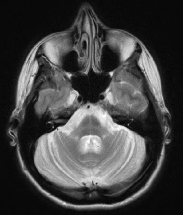 20A5 MSA (Case 20) T2 W 2 - Copy