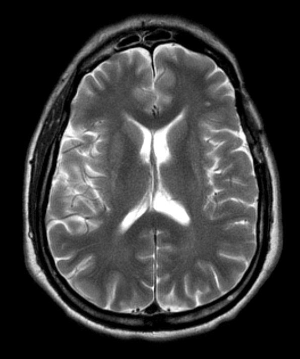 2A5 MSA (Case 2) T2 3 - Copy