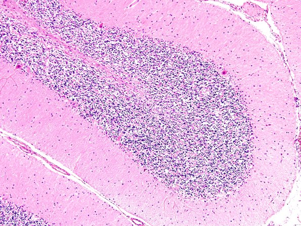 2E2 MSA (Case 2) L14 Cerebellum H&E 3