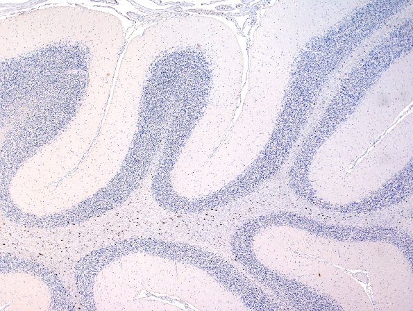 2F1 MSA (Case 2) L14 Cerebellum pSYN 4X