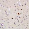 4H1 MSA (Case 4) gray matter pSYN 1