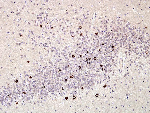 4I2 MSA (Case 4) HC dentate pSYN