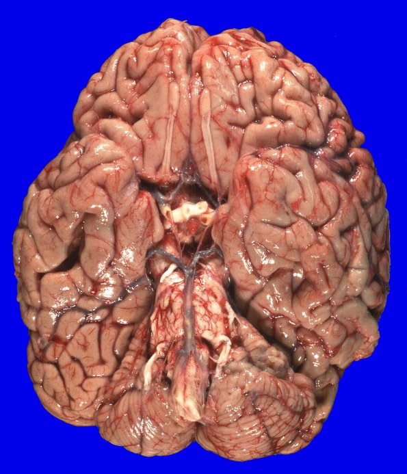 6A1 MSA (Case 6) 1