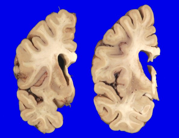 6A7 MSA (Case 6) 9