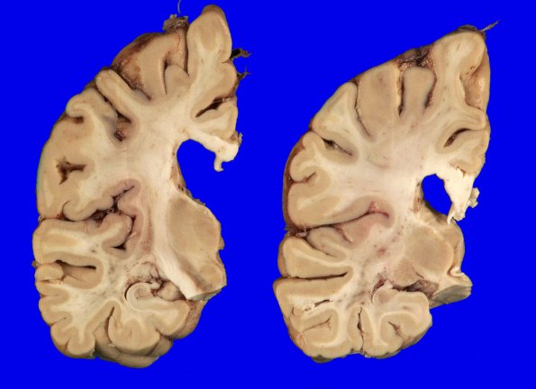 6A9 MSA (Case 6) 11