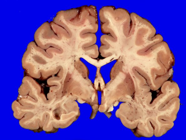 7A1 MSA (Case 7) _5