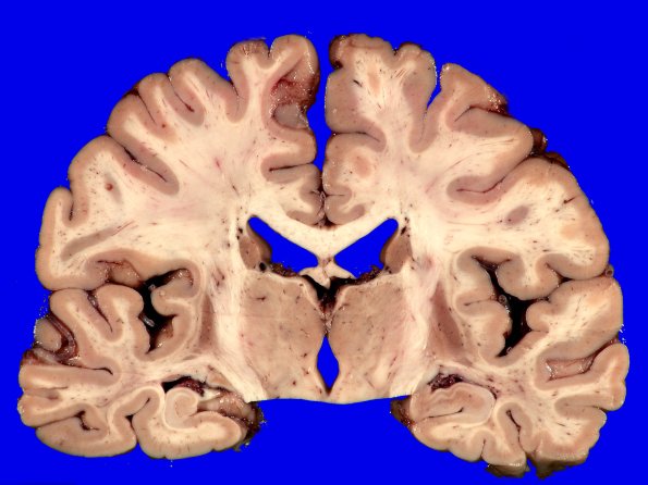 7A2 MSA (Case 7) _6