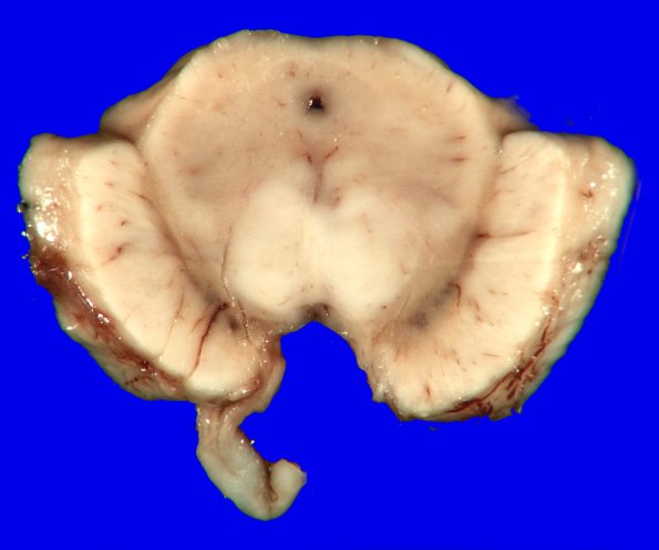 7A4 MSA (Case 7) _8