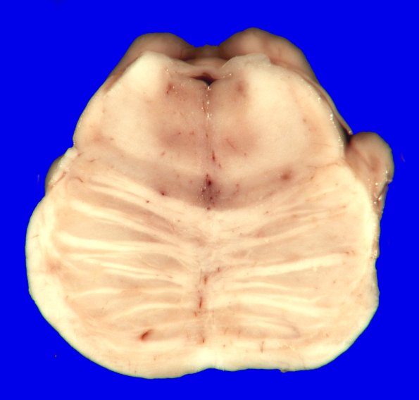 7A5 MSA (Case 7) _10