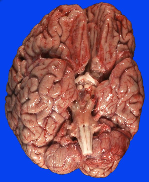 8A1 MSA (Case 8) 1