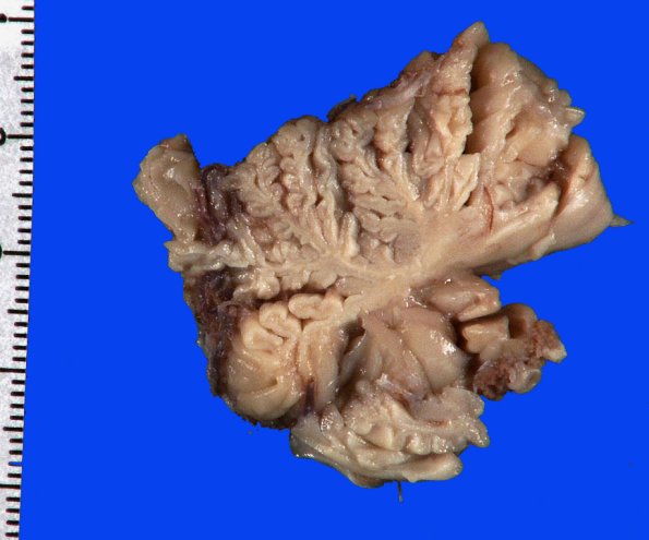 8A14 MSA (Case 8) 16