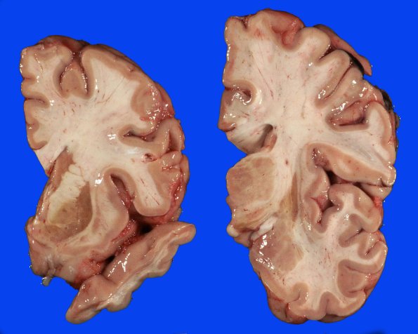 8A5 MSA (Case 8) 8