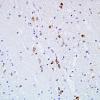 8B4 Multiple system atrophy (MSA, Case 8) BG pSYN 2.jpg