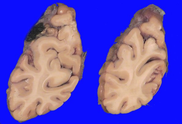 5A8 Pick Dz (Case 5) _8
