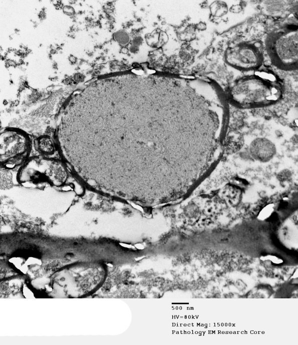 3E1 PGB (Case 3) SC EM 061 - Copy