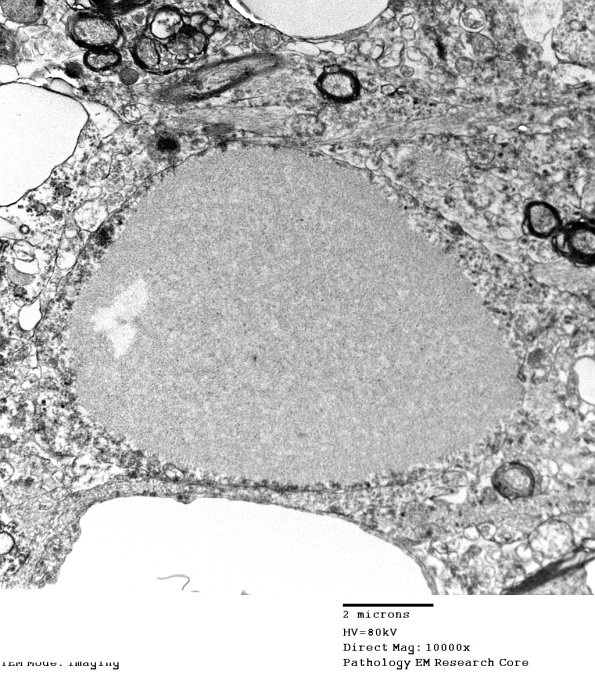 3E7 PGB (Case 3) SC EM 022 - Copy