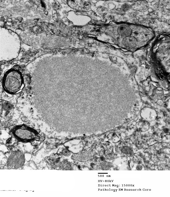 3E9 PGB (Case 3) SC EM 012 - Copy