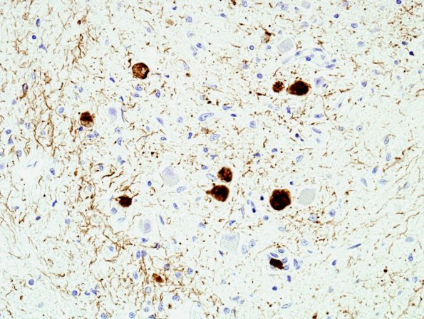 3B7 PSP (Case 3) ION PHF 1