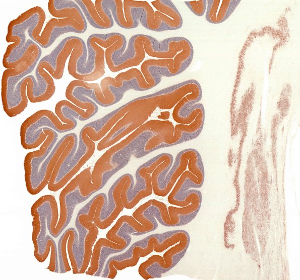 4D1 PSP (Case 4) L14 SYN whole mount