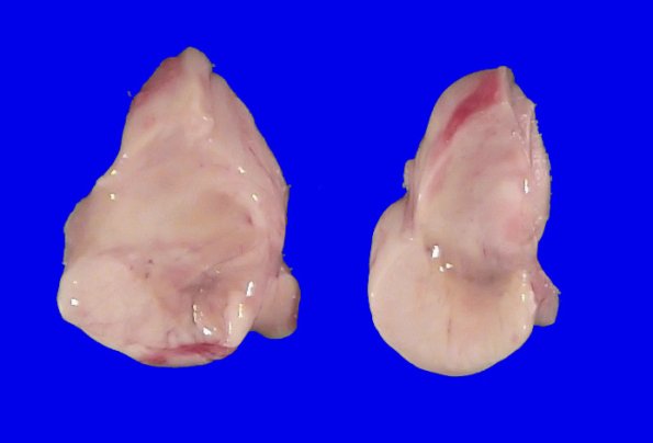 7A2 PSP (Case 7) Gross_5