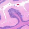 1A1 Cerebellum, normal (Case 1A) H&E 7 copy