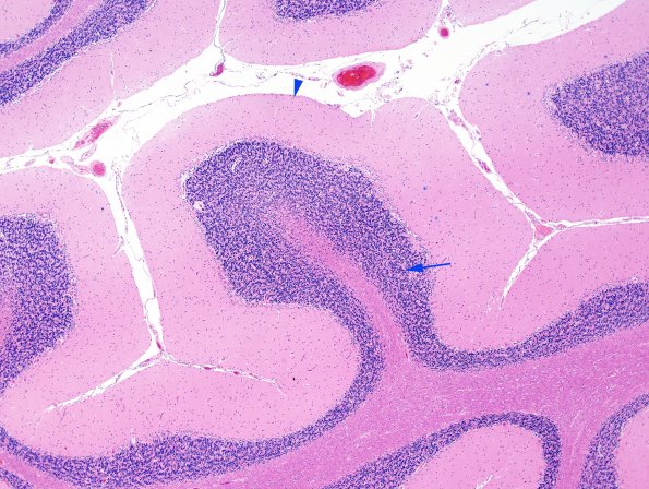 1A1 Cerebellum, normal (Case 1A) H&E 7 copy