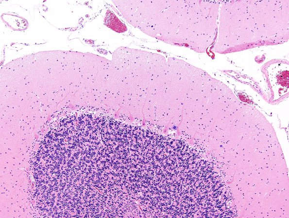 1A2 Cerebellum, normal (Case 1A) H&E 5