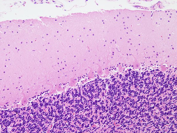 1A3 Cerebellum, normal (Case 1A) H&E 2