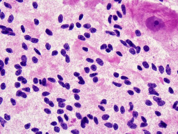 1A7 Cerebellar Cortex (Case 1B) Smear 4