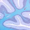 1B1 Cerebellum, normal (Case 1C) LFB-PAS 3 copy