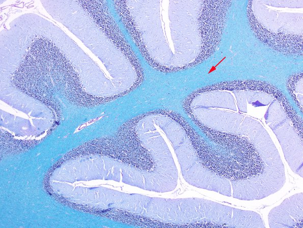 1B1 Cerebellum, normal (Case 1C) LFB-PAS 3 copy