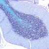 1B2 Cerebellum, normal (Case 1C) LFB-PAS 2