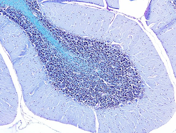 1B2 Cerebellum, normal (Case 1C) LFB-PAS 2