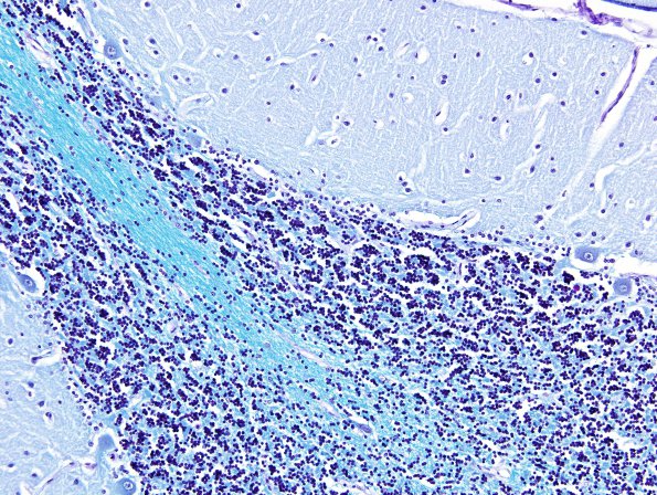 1B3 Cerebellum, normal (Case 1C) LFB-PAS 1