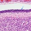 2A Cerebellum, 32 week gestation (Case 2) H&E 1 copy