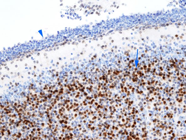 2B Cerebellum, immature (Case 2) NeuN 1 copy