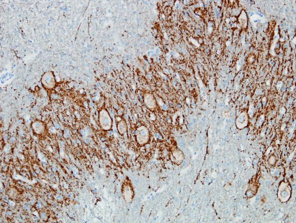 4A2 Cerebellum, dentate nucleus (Case 4) SYN 3