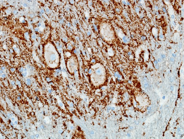 4A3 Cerebellum, dentate nucleus (Case 4) SYN 4