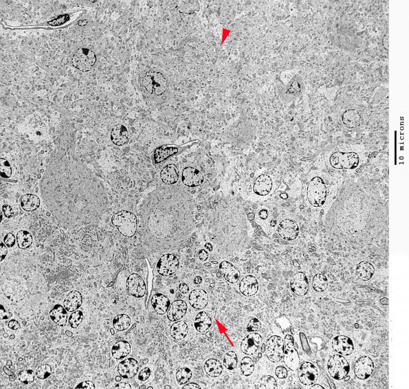 5A1 Normal Mouse Cerebellum WT Cerebellum (06-211A) EM 38 - Copy