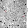 5A2 iPLA2beta WT Cerebellum (06-211A) nl Purkinje  & granule cells EM 34 copy - Copy